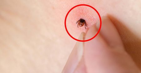 Zauważyłeś na skórze? Niestety kleszcz był zakażony