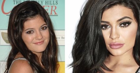 Kylie chwali swoje wypełniacze: "Polecam je każdemu. Wyglądam NATURALNIE!"