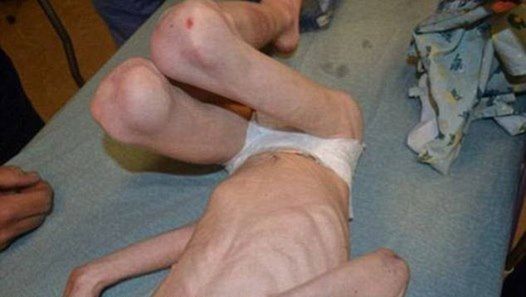 Ojciec i macocha znęcali się nad synem i głodzili go