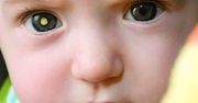 Czy zauważyłeś "złote oczy" na fotografiach twojego dziecka? To może być nowotwór