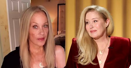Tak dziś wygląda zmagająca się ze stwardnieniem rozsianym Christina Applegate. "Nowy kolor włosów i nowa dziwna plama na policzku" (FOTO)