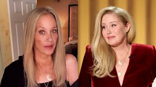 Tak dziś wygląda zmagająca się ze stwardnieniem rozsianym Christina Applegate. "Nowy kolor włosów i nowa dziwna plama na policzku" (FOTO)
