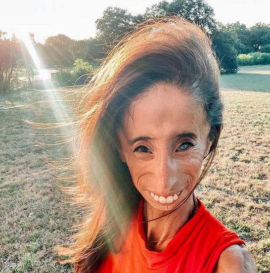 Lizzie Velásquez prężnie działa w mediach społecznościowych