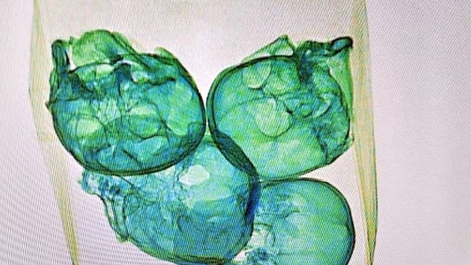 Zawartość jednej z paczek wzbudziła podejrzenia na lotnisku 