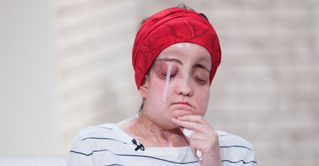 Polce przeszczepiono twarz. Pokazała się po 10 latach