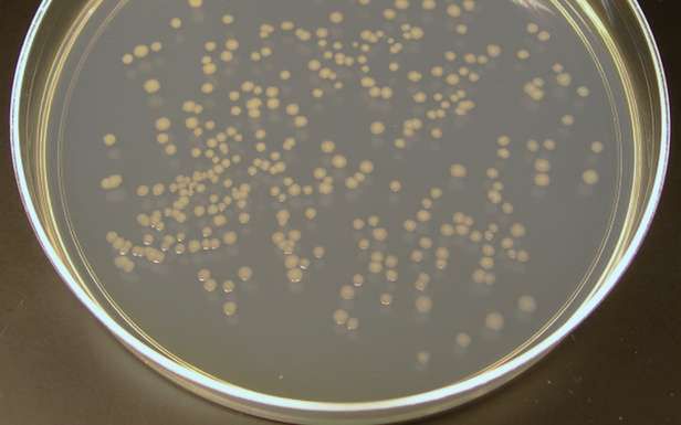 Hodowla E. coli na szalce Petriego (Fot. Wikimedia Commons)