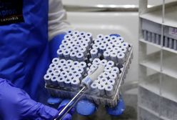 Aż się włos jeży. Nowe odkrycia ws. COVID