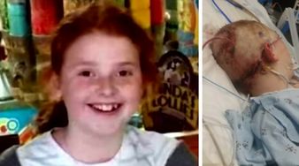 Koszmar 11-letniej dziewczynki. Została oskalpowana przez karuzelę!  