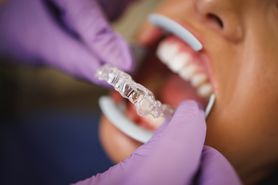 Aparat Invisalign - zalety, przebieg leczenia, przeciwwskazania, niewidoczne prostowanie zębów, nakładki ortodontyczne