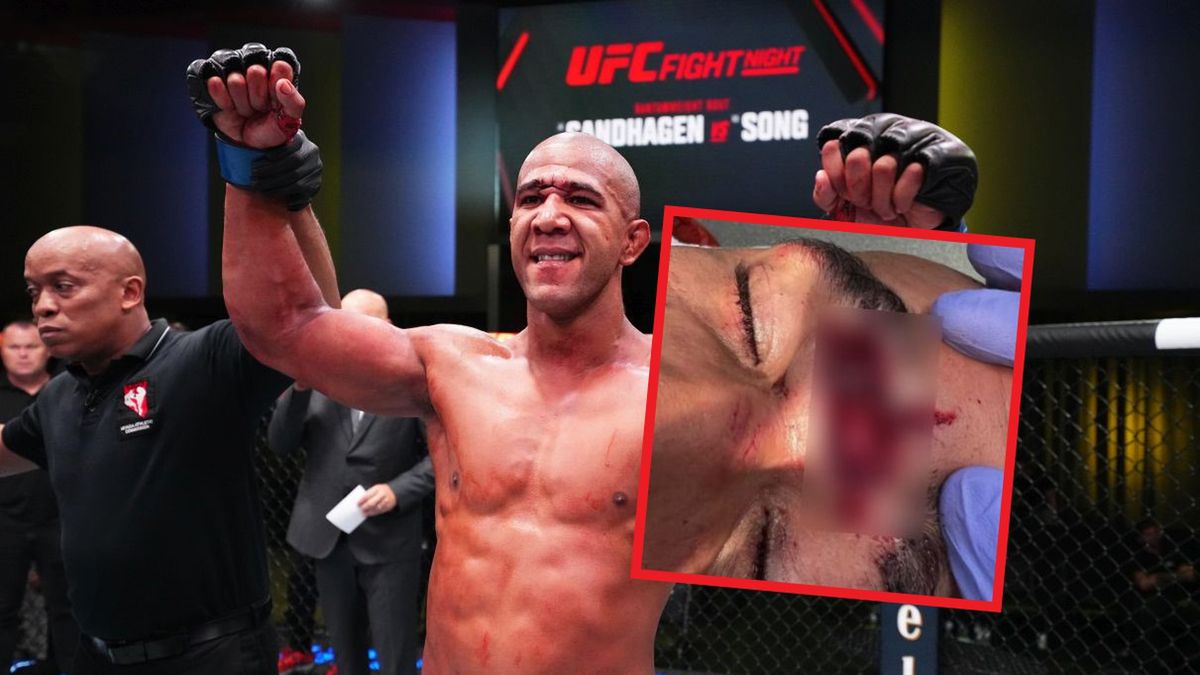Zdjęcie okładkowe artykułu: Getty Images / Chris Unger / Instagram/Dana White / Na zdjęciu: Gregory Rodrigues po zwycięstwie na gali UFC Fight Night, na małym zdjęciu: kontuzja Rodriguesa