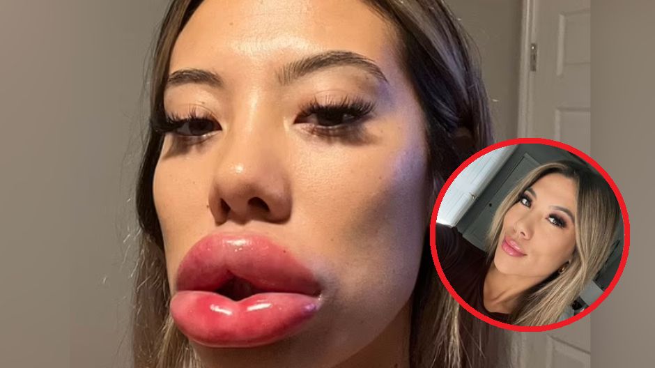 Nieudany zabieg sprawił, że 24-latka wylądowała w szpitalu