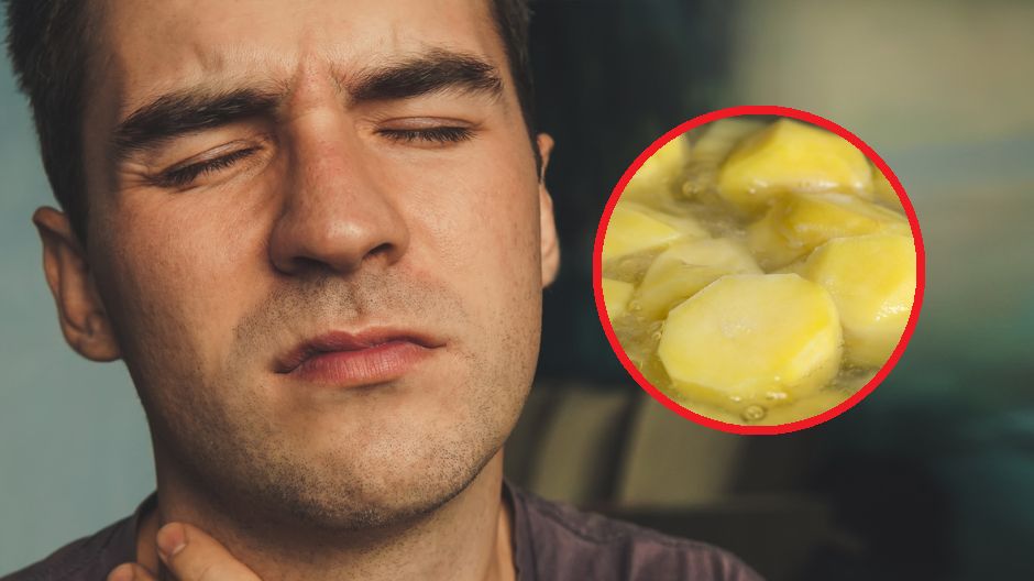 Część pacjentów na ból gardła stosuje ciepłe okłady np. z ziemniaków