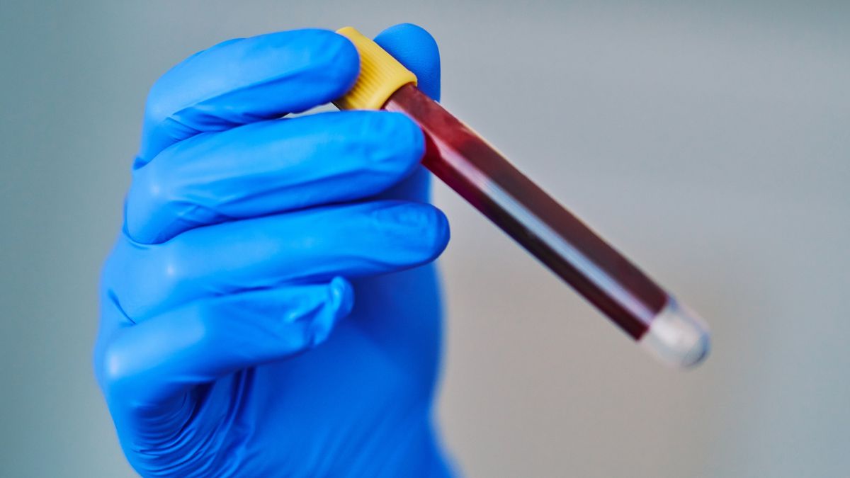 Shot of an unrecognisable gloved scientist holding a test tube filled with blood in a laboratory
LaylaBird
unretouched