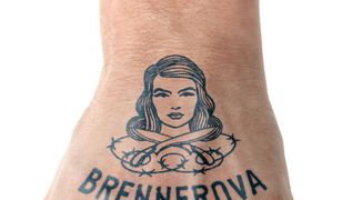 Brennerova