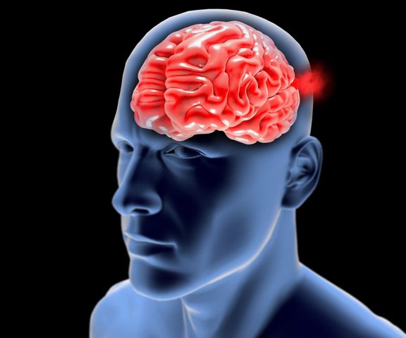  Czym jest opryszczkowe zapalenie mózgu?