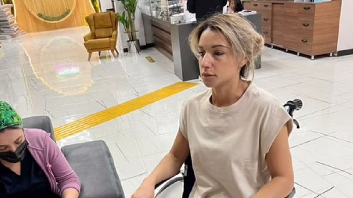 Tiktokerka opowiedziała o zabiegu w Turcji