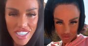 Katie Price LEDWO porusza twarzą. Właśnie zapowiedziała kolejną operację: "Chcę, żeby wyglądał jak nadmuchiwany balon"