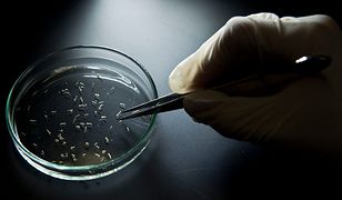 Naukowcy badają wirusa Zika. To przez niego dzieci rodzą się z małogłowiem?