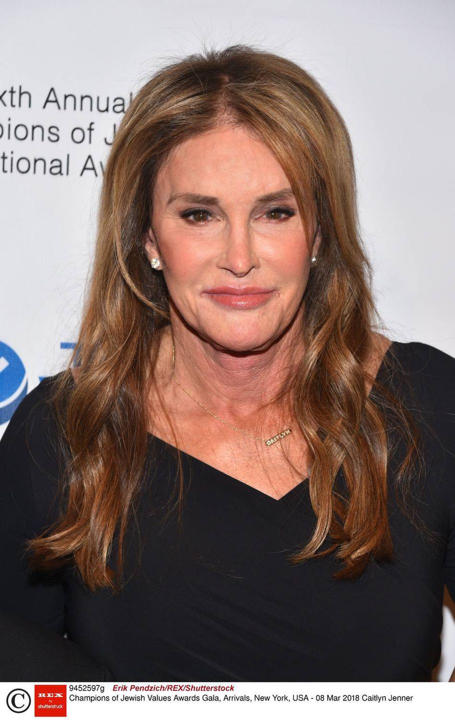 Caitlyn Jenner – przerzedzająca się fryzura