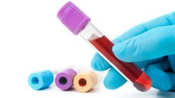 INR - wskazania, normy, zaburzenia krzepnięcia krwi