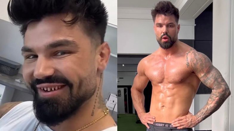 Paweł Tyburski z "Love Island" zrobił sobie zęby