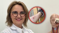 Na jej nodze pojawiła się swędząca gruda. "Jestem weteranką boreliozy"