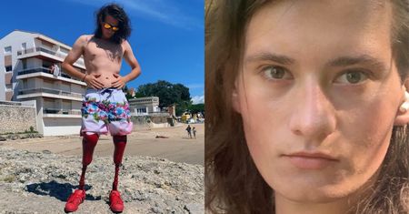 "Top Model". Fani oburzeni eliminacją uczestnika z protezami nóg: "Wykorzystali go tylko do PODBICIA OGLĄDALNOŚCI"