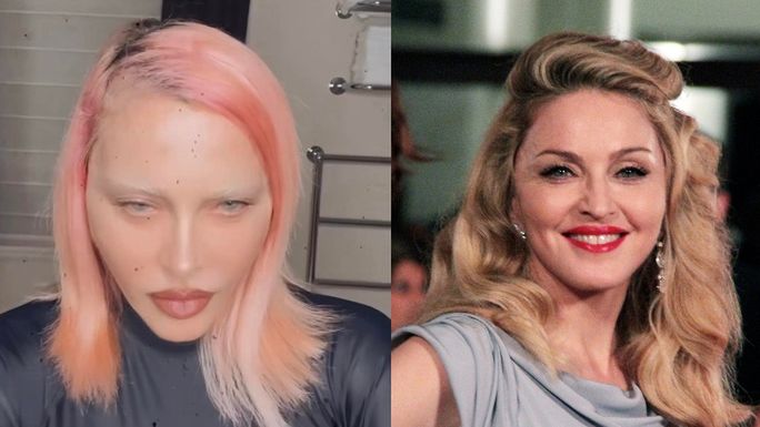 Chirurg gwiazd wymienia, jakimi zabiegami Madonna OSZPECIŁA swoją twarz w ostatnim czasie