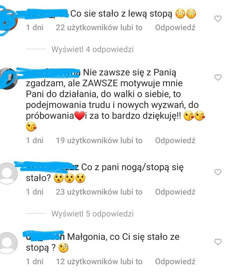 Małgorzata Rozenek - co z jej stopą?