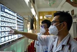 WHO podało najpoważniejszą zakaźną przyczynę śmierci na świecie