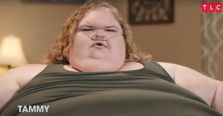 Tammy Slaton z "Sióstr wielkiej wagi" przeszła operację USUNIĘCIA SKÓRY! Tak teraz wygląda