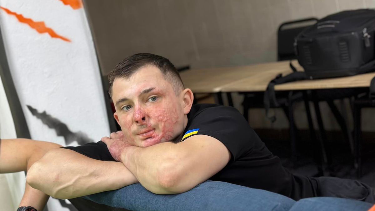 Uratował się z płonącego czołgu