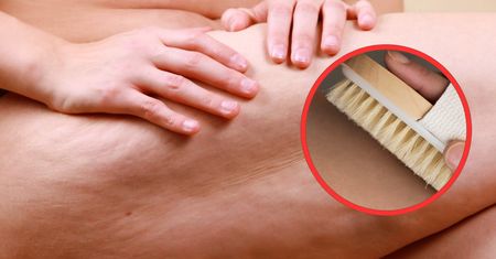 Cellulit zacznie znikać. Oto jedna z najbardziej polecanych metod