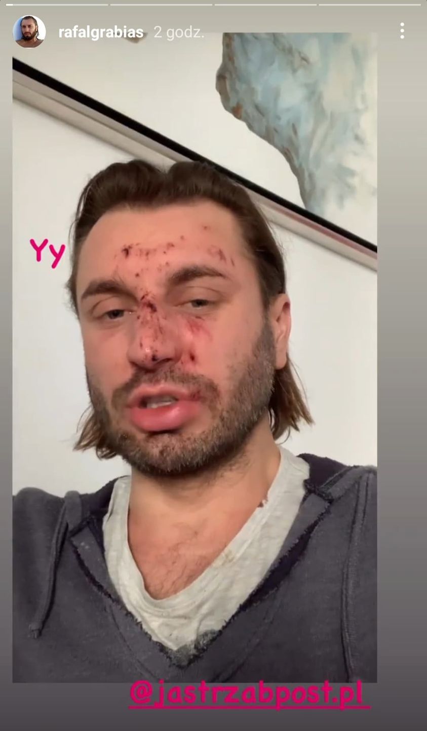 Rafał Grabias napadnięty i pobity