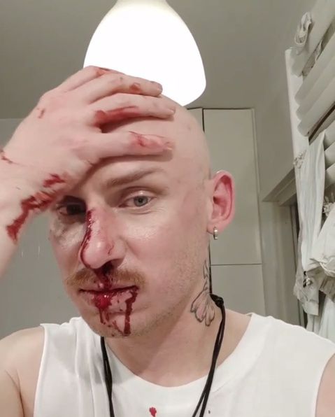 Jacek Szawiola z "Gogglebox" został pobity