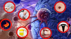 10 ignorowanych znaków ostrzegawczych, które mogą świadczyć o raku