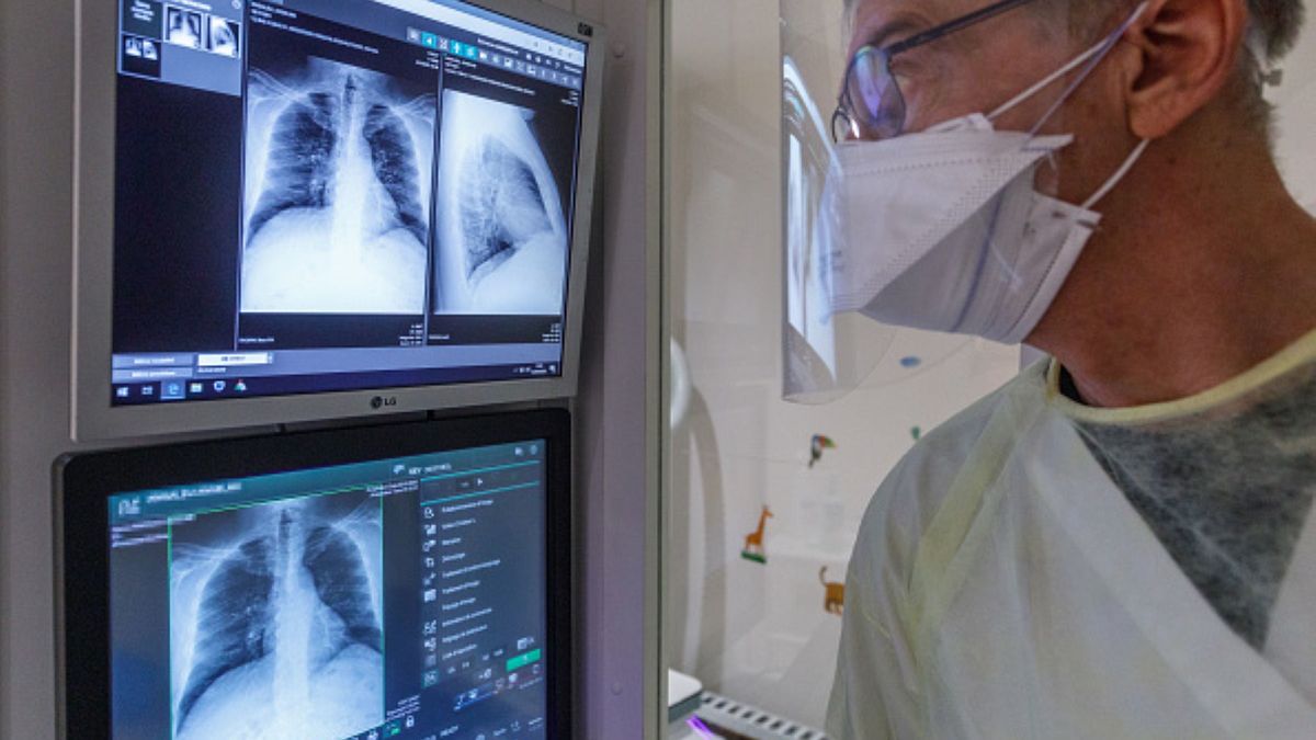 Koronawirus dokonuje poważnych uszkodzeń płuc