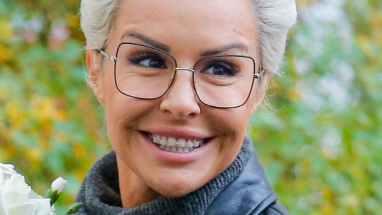 Blanka Lipińska z twarzą NAKŁUTĄ IGŁAMI  raduje się po kolejnym zabiegu: "NACIĄGNĘŁAM SIĘ" (FOTO)