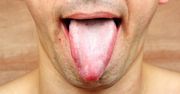 Pojawia się na języku. Od razu idź do lekarza