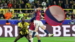 To nie fotomontaż. 18-latek z Barcelony pokazał szyję po meczu