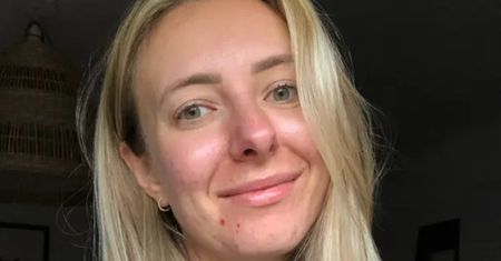 28-latka przez siedem lat ukrywała bolesny sekret. W końcu o nim opowiedziała