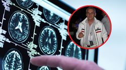 Tak sprawiasz, że mózg się szybciej starzeje. Dr Jerzy Bajko, neurolog ostrzega