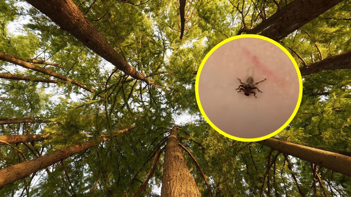 Po powrocie z lasu znalazła we włosach córki pełno takich stworzeń. Czym są?