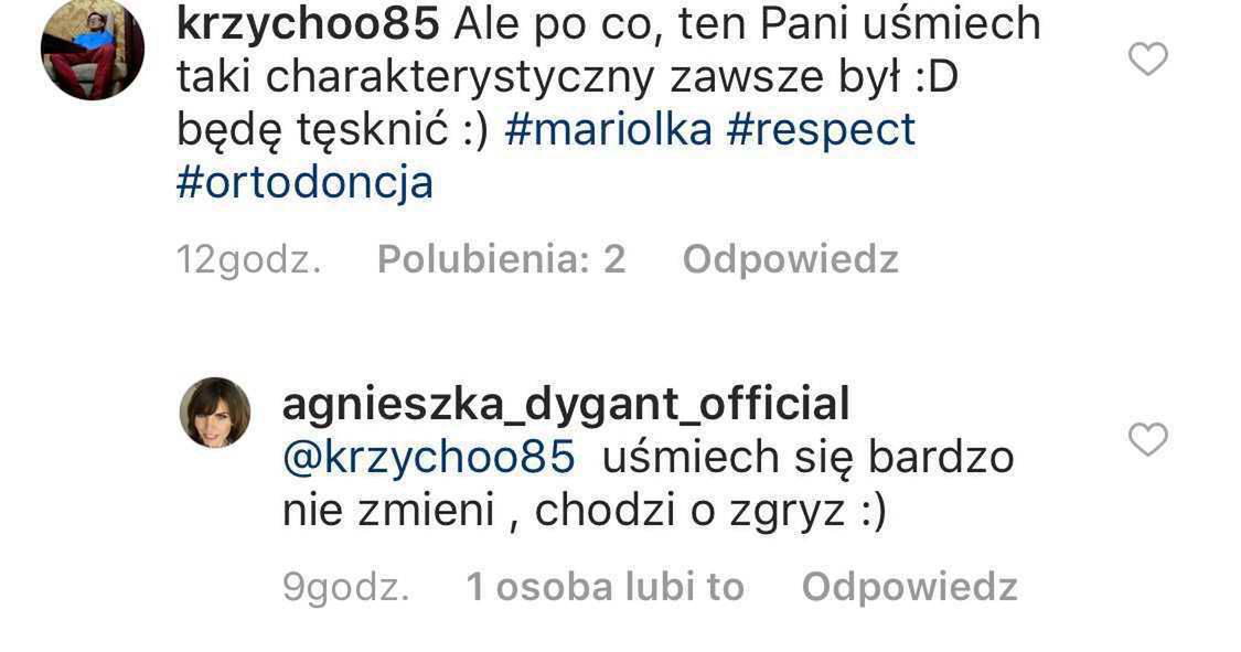 Agnieszka Dygant założyła aparat na zęby