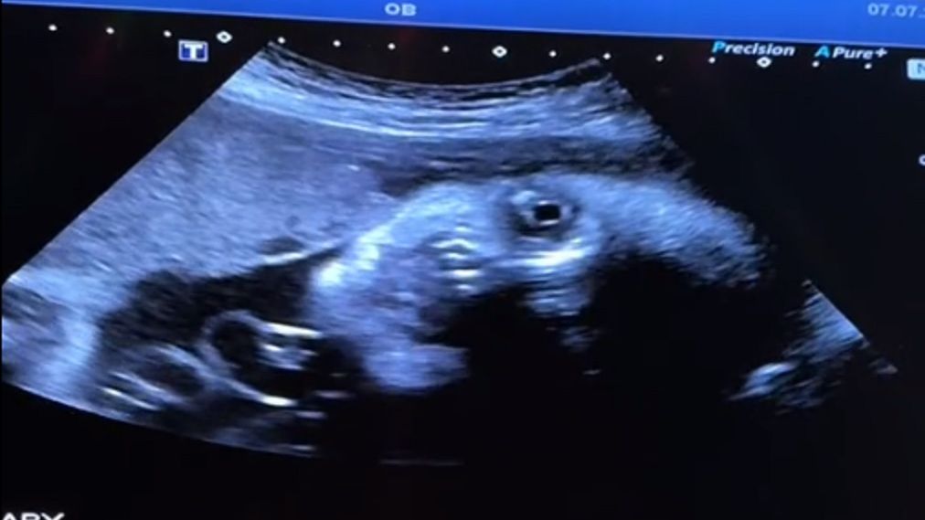 Rodzice byli w szoku