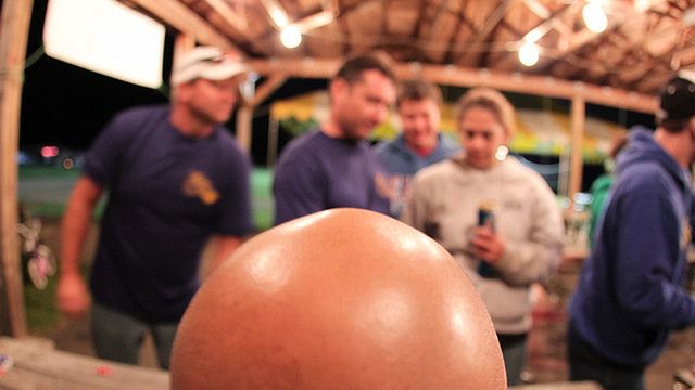 Naukowcy wiedzą już, dlaczego łysiejemy i jak to powstrzymać 1