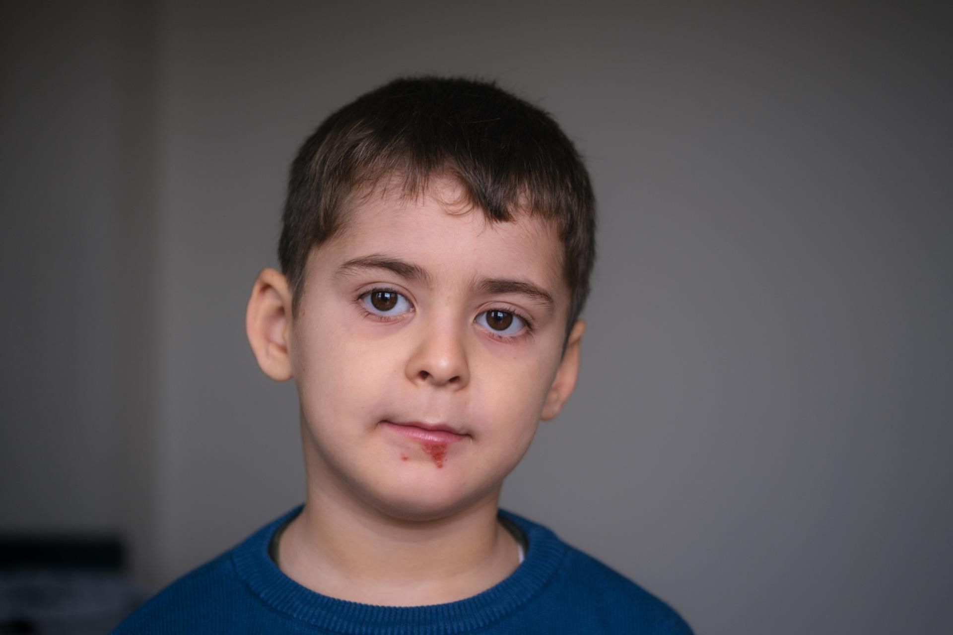 Wirus HSV-1 może wywoływać zapalenie mózgu