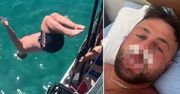Robił salto do wody.  Założono mu 50 szwów na twarzy