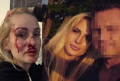 Pobita Katarzyna Dziedzic w Polsacie:"Zobaczyłam w jego oczach szał"