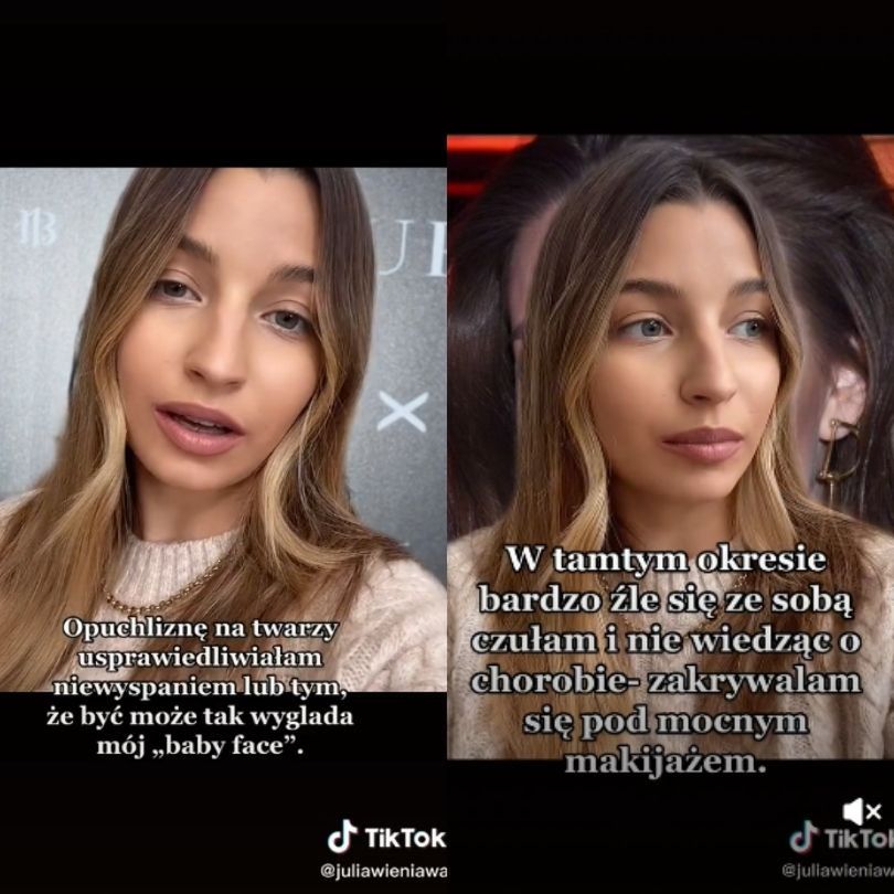 Julia Wieniawa pokazuje stare zdjęcia i otwiera się na temat choroby tarczycy